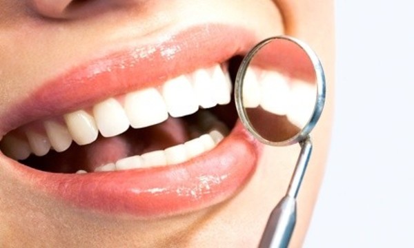 $89 for In-Office Teeth Whitening at Dr. Amal Al-Fares DDS LLC ($300 Value)
