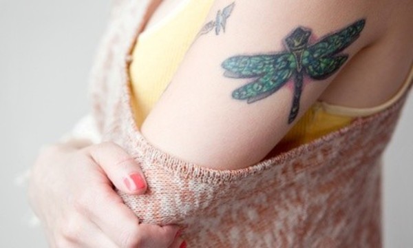 Laser Tattoo Removal on a 3"x3", 6"x6", or 9"x9" Area at Skinsational Liposculpture Center (Up to 66% Off)