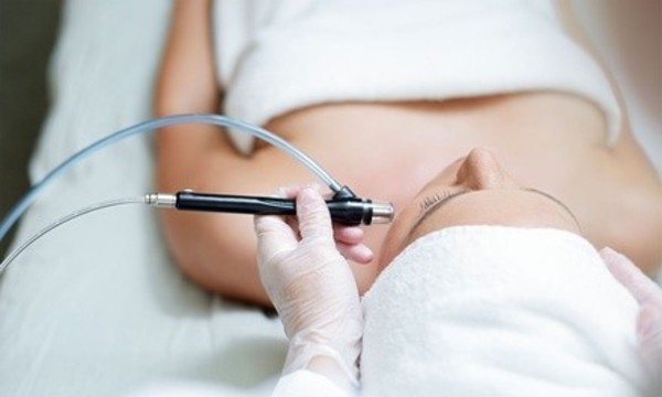 One or Three Microdermabrasion Treatments with Collagen Mask at Total Body Wellness Spa (Up to 77% Off) 