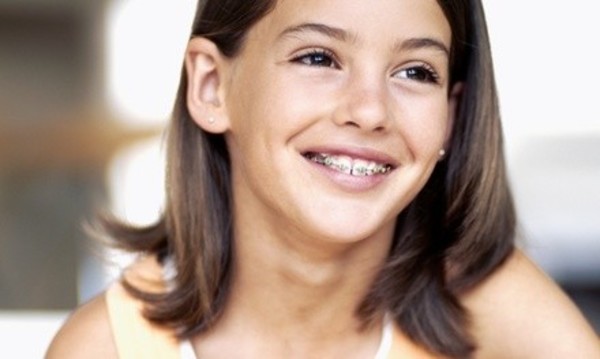 $49 for an Exam and X-rays with Credit Toward Invisalign or Braces at Dr. Stephen J. Breaud Orthodontics ($500 Value)