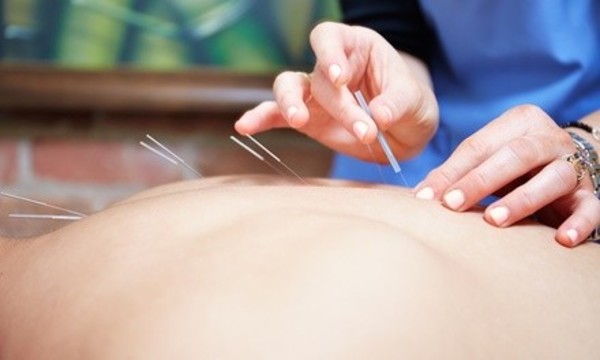 One Consultation with Two, Four or Six Acupunctures at Wong's Acupuncture (Up to 62% Off)