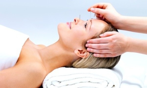 $125 for $250 Worth of Services — Empowered Acupuncture