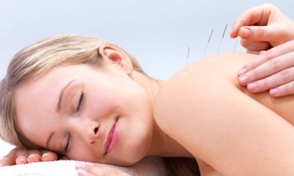 Acupuncture Treatments for Fertility, Weight Loss, and Stress at Manhattan Wellness Group (Up to 52% Off) 