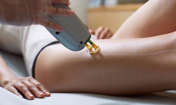 Laser Hair Removal Treatment at Smooth Laser Spa (Up to 81% Off). Four Options Available.