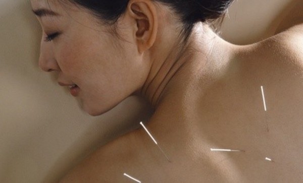Acupuncture for One or Two or Herbal Treatment for One or Two at Natural Health Center of Austin (Up to 86%Off)