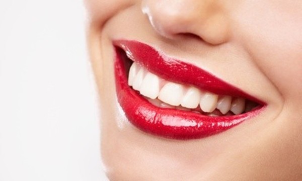 Dental Services at Hamilton Smiles (Up to 93% Off). Four Options Available.