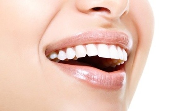 Dental Exam, X-Ray, And Basic Cleaning or Teeth Whitening Treatment at EZ Dental South Loop  (Up to 85% Off)