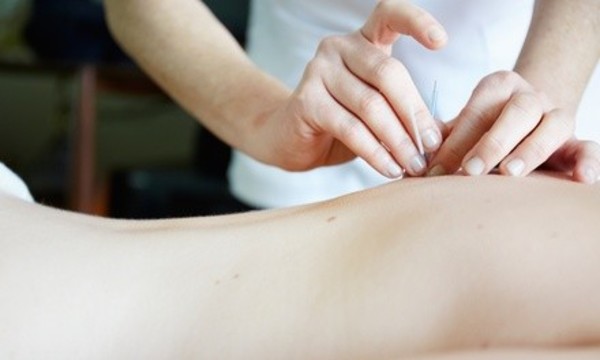 One, Three, or Six 60-Minute Acupuncture Sessions with Consultation at ACU Family Care Clinic (Up to 86% Off)