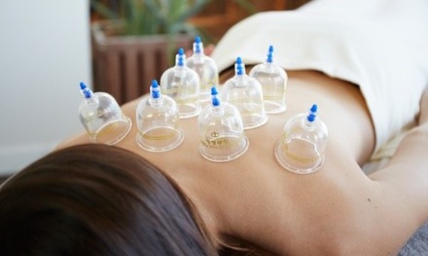 One or Three Cupping Sessions at Manhattan Wellness Group (Up to 67% Off)