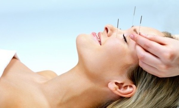 Consultation with One or Two Acupuncture Sessions at Whole Body Health Center (Up to 59% Off)