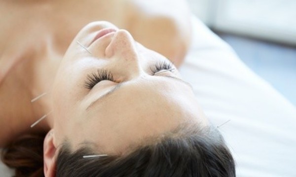 One or Three Acupuncture Sessions at Wu's Acupuncture & Natural Healing (Up to 71% Off)