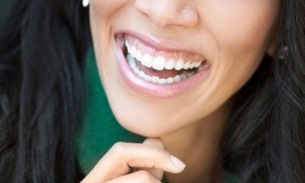 $29 for a New-Patient Dental Package with Exam, X-rays, and Teeth Cleaning at Aharon & Associates ($248 Value)
