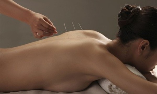 Acupuncture Session and Consultation at Natural Way Health Center (Up to 81% Off). Four Options Available.
