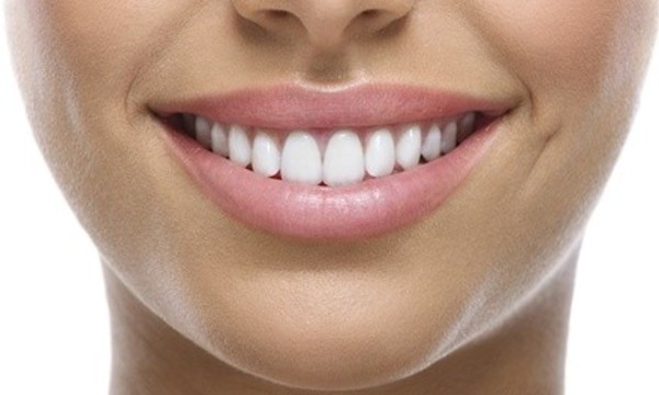 Dental Services at Dental 2000 (Up to 84% Off). 3 Options Available