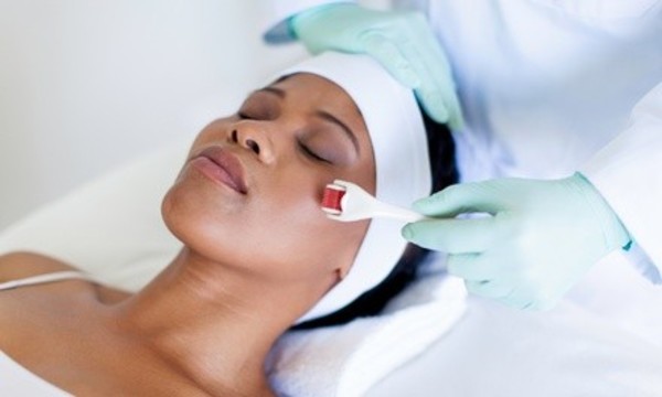 Two or Four Microneedling Sessions at In the Buff Day Spa and Salon (Up to 55% Off)