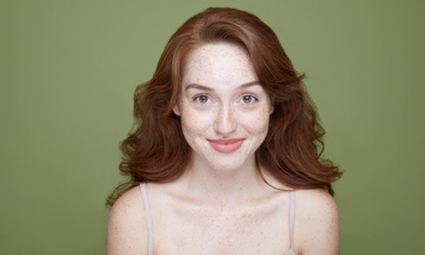 One VI Peel at Pure Laser Skin & Vein MedSpa USA (46% Off)  