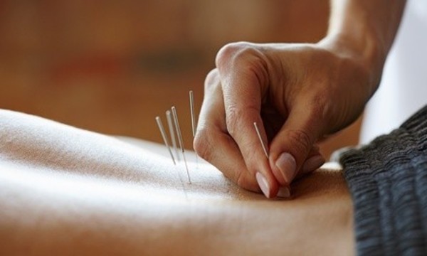 One or Two 75-Minute Acupuncture Sessions at Seattle Institute of Oriental Medicine (Up to 69% Off)