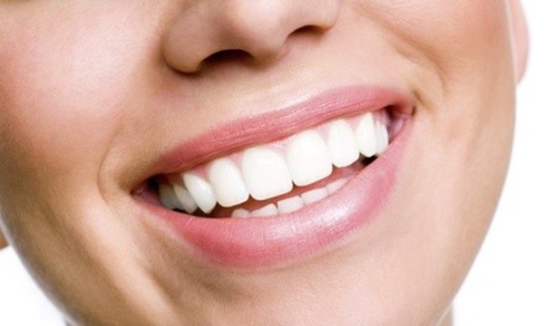 Boost Teeth Whitening Treatment with Exam and X-Ray for One or Two at Clear Dental (Up to 88% Off)