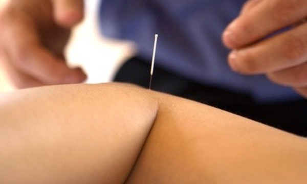 Consultation, Assessment, and One or Two Acupuncture Treatments at Han Acupuncture (Up to 37% Off)