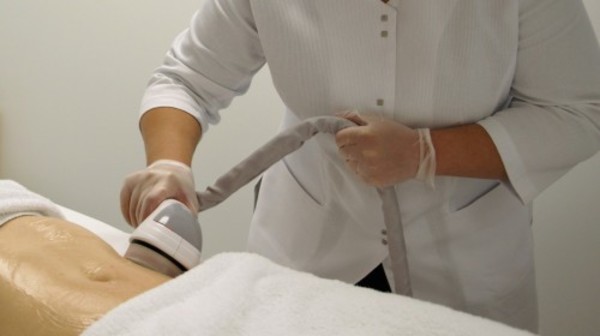 Q Spa+ - One Lipo Cupping Massage Session