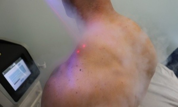 One or Three Localized Cryotherapy Sessions at CryoPoint (Up to 53% Off)
