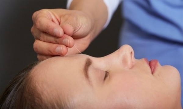 One or Two Acupuncture or Needleless-Acupuncture Sessions at AB Acupuncture (Up to 52% Off)