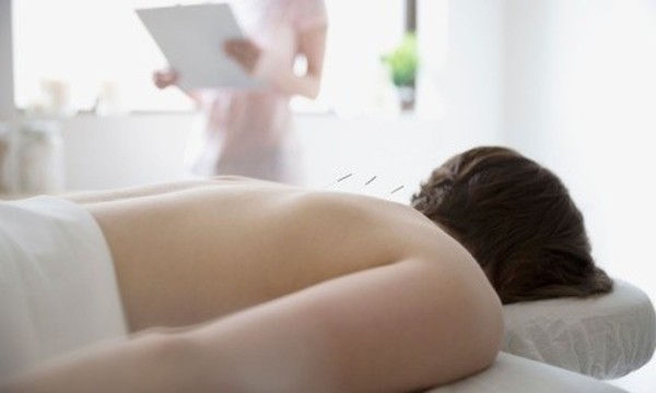 One 60-Minute Community Acupuncture Sessions at Acupuncture Health For Life (Up to 60% Off)