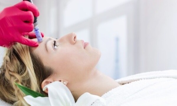 One Microneedling Treatment for Face or Face and Neck at Skincare 212 (Up to 67% Off)
