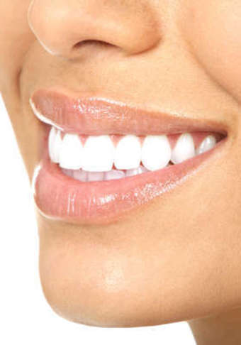 One, Three, or Five IPL Photofacials at Vitalogy Wellness (Up to 71% Off)