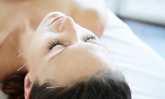 One or Three Acupuncture Sessions at Wu's Acupuncture & Natural Healing (Up to 74% Off)