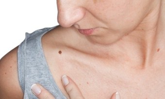 Removal of 1, 3, 6, or 15 Skin Tags or Brown Spots or 2 Moles at Just For You Salon & Spa (Up to 78% Off)