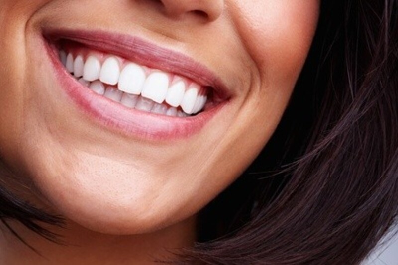 Up to 40% Off on Teeth Whitening - In-Office - Non-Branded at Integrity tanning and teeth whitening