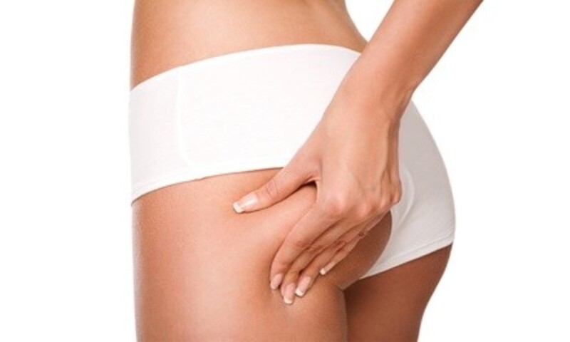 One or Three VelaShape III Sessions at UniQ Laser Center (Up to 81% Off)