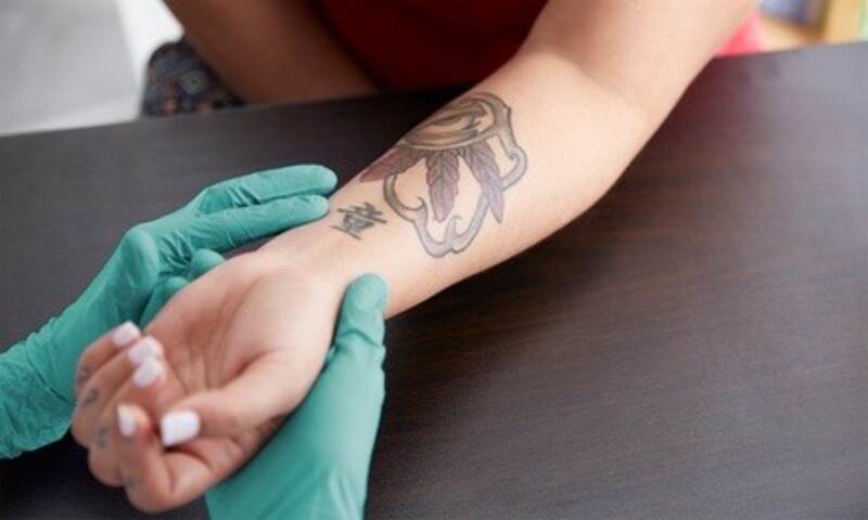 One Laser Tattoo-Removal Session for One Small or Medium Area at ReGen Laser (Up to 81% Off)