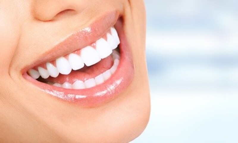 $88 for an In-Office Teeth-Whitening Treatment at BodyBrite ($129 Value)
