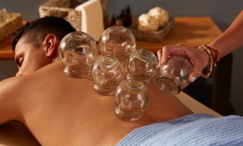 One or Three Cupping Sessions or One Sports Taping Session at Back To Motion (Up to 60% Off)