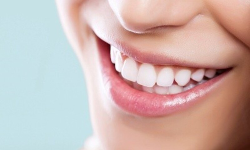 Professional-Grade Teeth Whitening for One or Two People at Changes Medical Spa (Up to 78% Off)