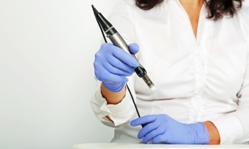 One or Three Microneedling Treatments w/ Vitamin C & Optional Hyaluronic Acid Facial at Ura Spa (Up to 67% Off)