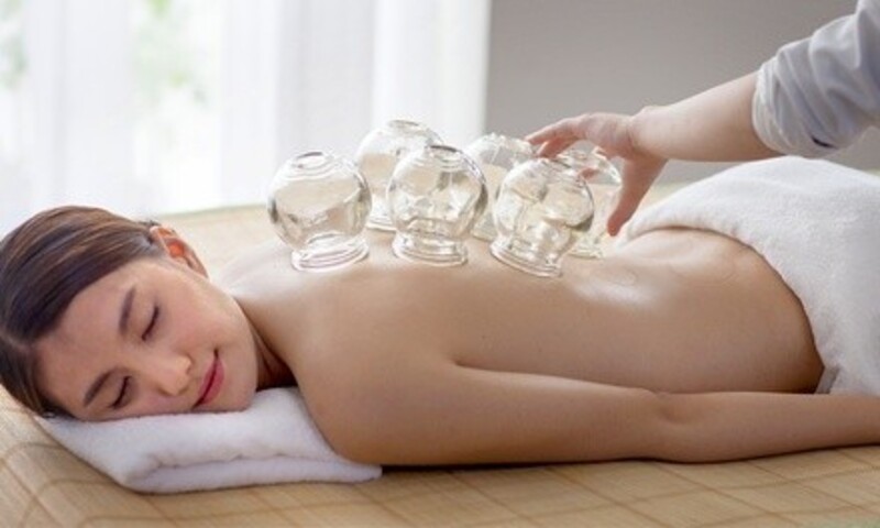 One or Three Cupping Sessions at Source of Health Natural Medical Center (Up to 71% Off)
