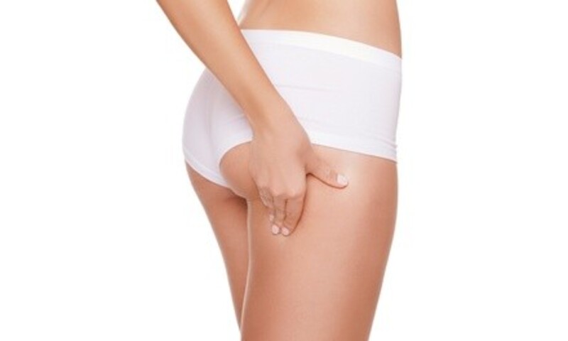 Two, Four, or Six Treatments of Cellulite Reduction using Thermalift at Bella Luna Day Spa (Up to 89% Off) 