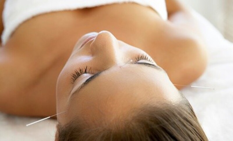 Laser or Traditional Acupuncture Treatments at Integrated Acupuncture Services (Up to 54% Off)