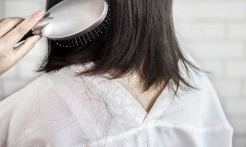 Up to 50% Off on Hair Restoration - Laser at Carolina Peach Hair Restoration