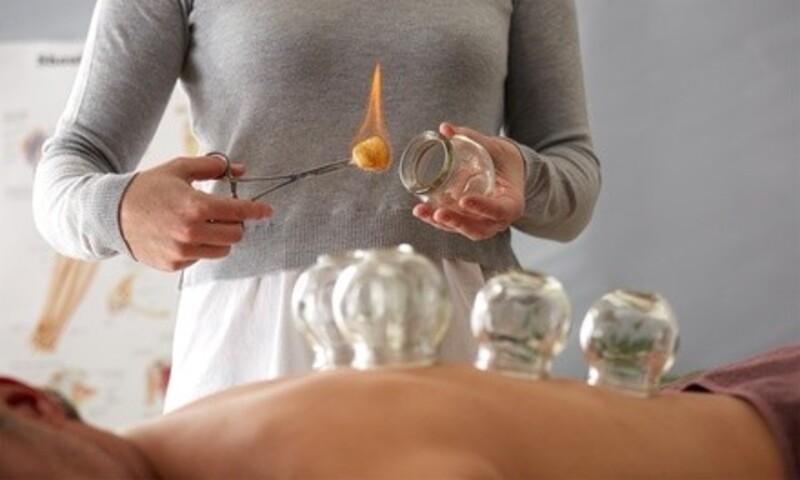 Up to 33% Off on Cupping at Natural Acupuncture & Cupping Center