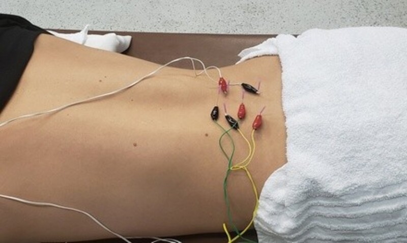 One or Three Dry-Needling Sessions at Spark Performance and Physiotherapy (Up to 52% Off)
