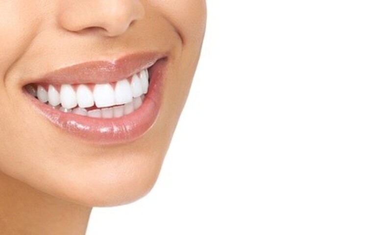 $46.40 for Two Teeth Whitening Sessions at FS Mouthguards ($200 Value)