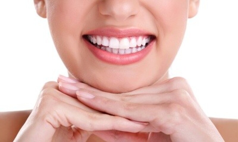 30-Minute In-Office Teeth-Whitening Session for One or Two at MySmile (Up to 64% Off) 