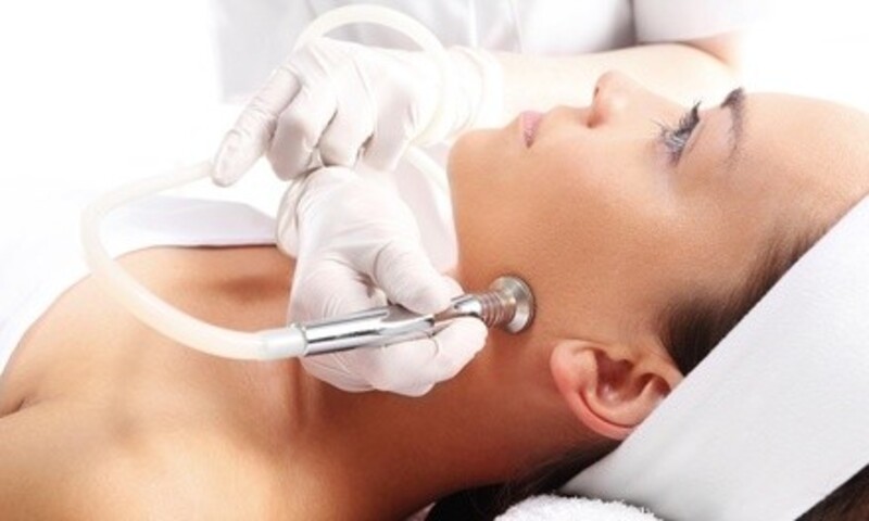 One Diamond Microdermabrasion with Eye and Lip Treatment or Light Peel at Rival Aesthetics (Up to 44% Off)