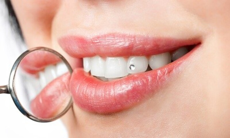$99 for Tooth Gem Application at Halo Med Spa ($150 Value)