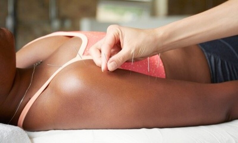 One or Two Acupuncture Sessions with Initial Exam at Integrated Oriental Medicine (Up to 87% Off)