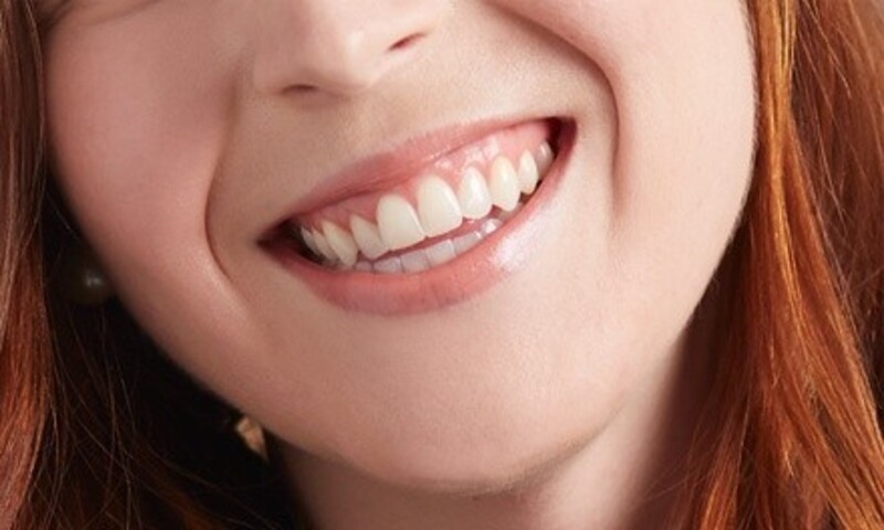 One In-Office Teeth-Whitening Session with an Optional Touchup at Smile Pretty (Up to 54% Off)